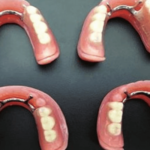 Removable Partial Dentures