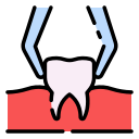 Tooth Removal