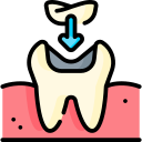 Dental Fillings